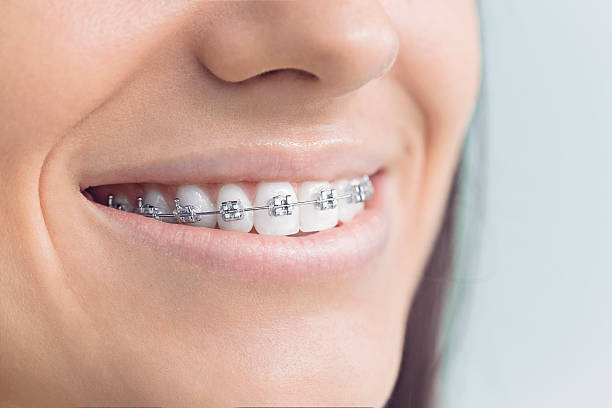 Best Dental Inlays and Onlays  in Dunnellon, FL